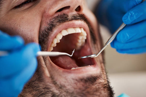 Best Wisdom Tooth Removal  in Edwardsvle, IL